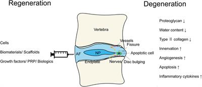 Regenerative therapies for lumbar degenerative disc diseases: a literature review